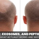 PRP, Exosomes, and Peptides: What Actually Works and Why