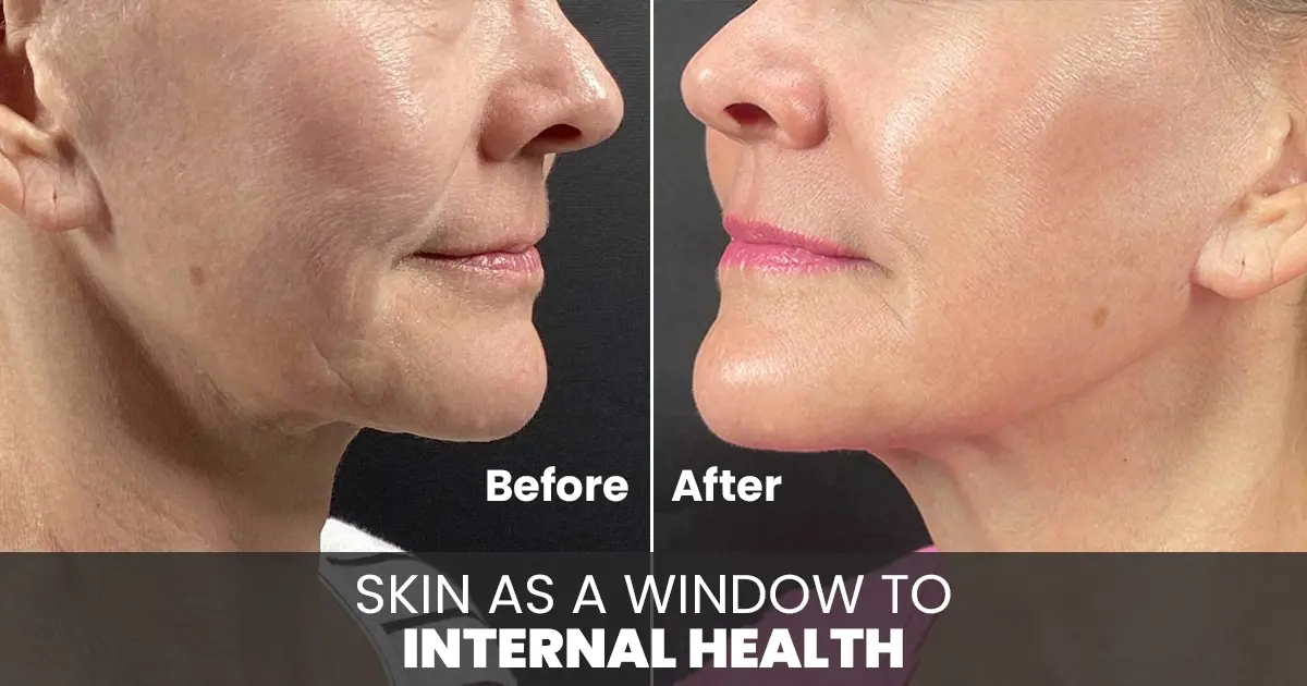 skin renewal treatment