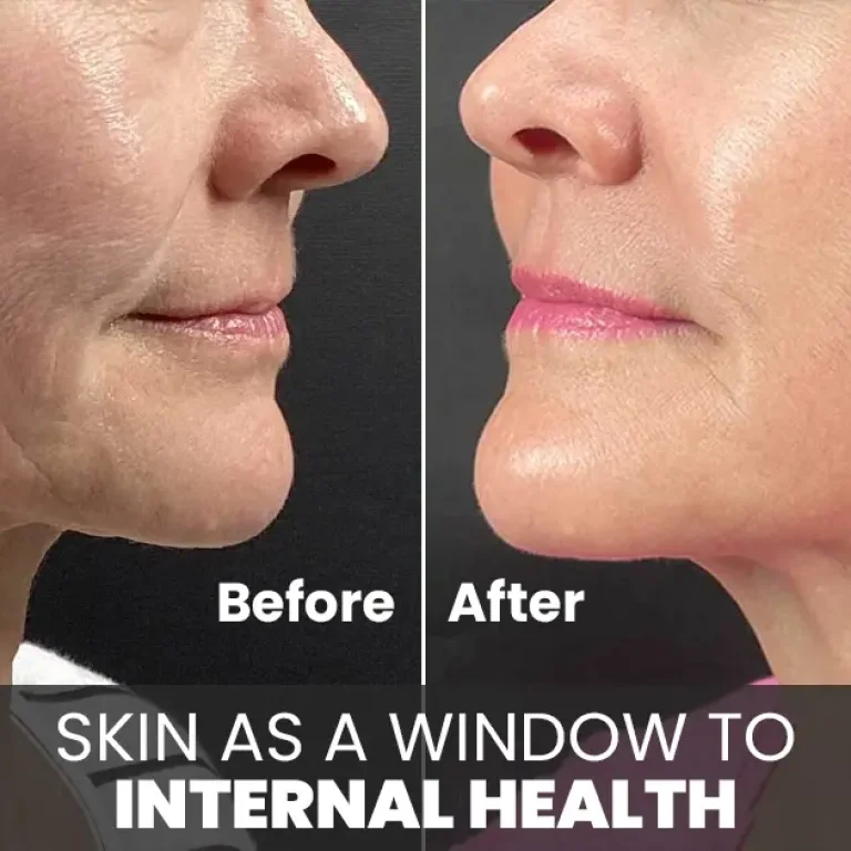 skin renewal treatment